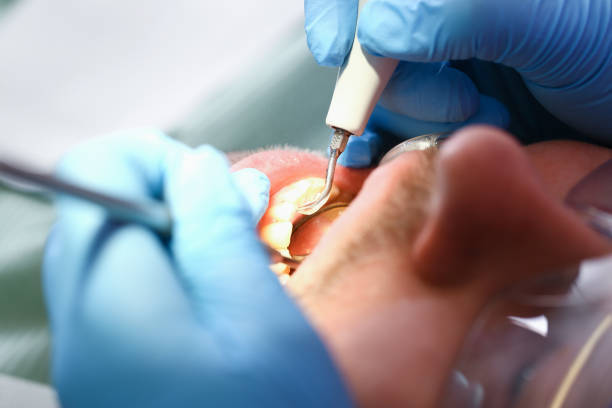 Best Tooth Pain Emergency Relief  in Aberdeen, OH
