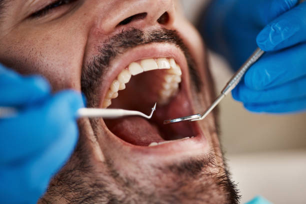 Best Tooth Infection Emergency Dentist  in Aberdeen, OH